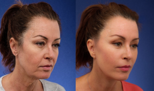 Alicja z Jaworzna, 44 lata